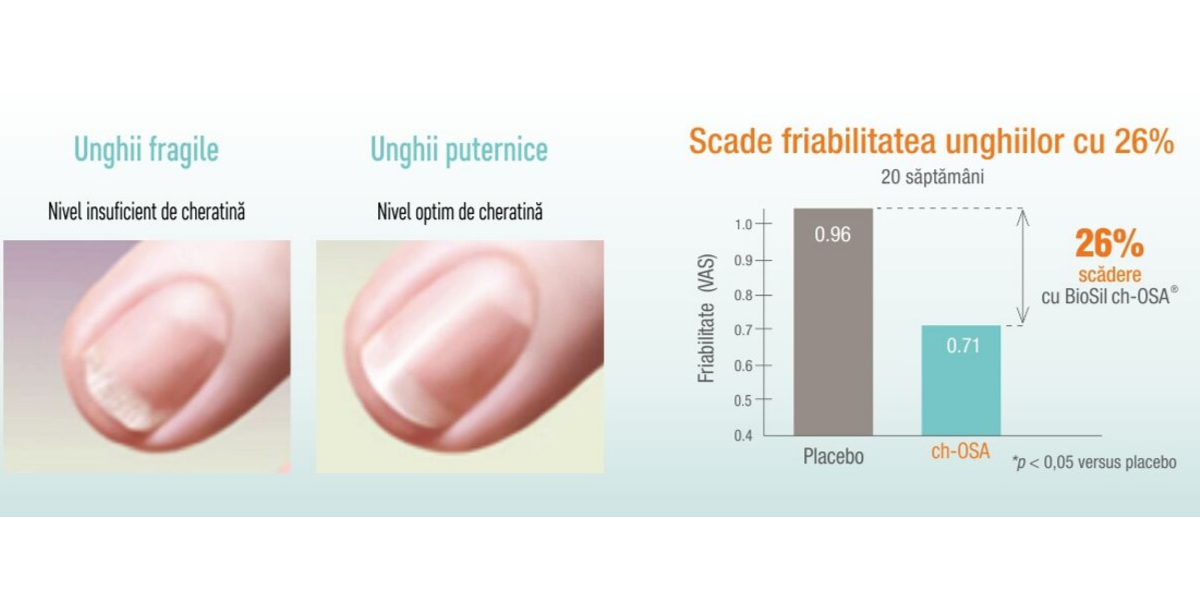 ioSil scade friabilitatea unghiilor pentru unghii puternice